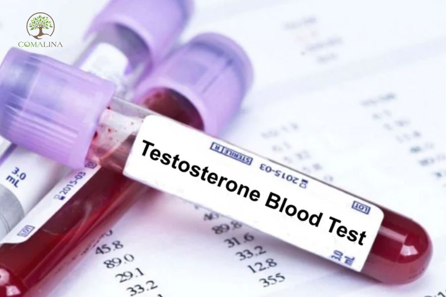 Testosterone-anh-huong-nhu-the-nao-toi-suc-khoe-va-sinh-ly-nam-3